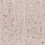 POU3F2 Antibody in Immunohistochemistry (Paraffin) (IHC (P))