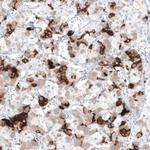 Prolactin Monoclonal Antibody (CL6550)