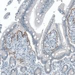 CD104 Antibody in Immunohistochemistry (Paraffin) (IHC (P))