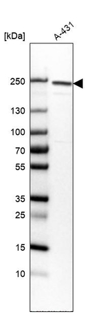 CD104 Antibody in Western Blot (WB)