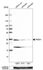TREM1 Monoclonal Antibody (CL7111)