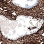 CD49a Antibody in Immunohistochemistry (Paraffin) (IHC (P))