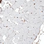 CD49a Antibody in Immunohistochemistry (Paraffin) (IHC (P))