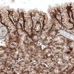 CD49a Antibody in Immunohistochemistry (Paraffin) (IHC (P))