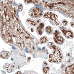 CD49a Antibody in Immunohistochemistry (Paraffin) (IHC (P))