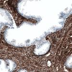 CD49a Antibody in Immunohistochemistry (Paraffin) (IHC (P))