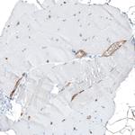 CD49a Antibody in Immunohistochemistry (Paraffin) (IHC (P))