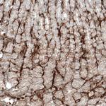 CD49a Antibody in Immunohistochemistry (Paraffin) (IHC (P))