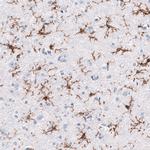 TMEM119 Antibody in Immunohistochemistry (Paraffin) (IHC (P))