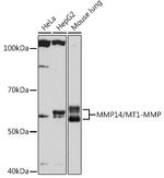 MMP14 Recombinant Rabbit Monoclonal Antibody (6T7L3)