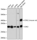 CDK2 Recombinant Rabbit Monoclonal Antibody (10E0N5)