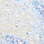 CCR7 Recombinant Rabbit Monoclonal Antibody (5U7S5)