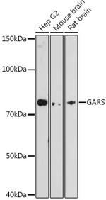 GARS Recombinant Rabbit Monoclonal Antibody (5Q5D7)