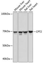 CPT2 Recombinant Rabbit Monoclonal Antibody (9V6M9)