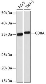 CD8a Antibody in Western Blot (WB)