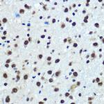 hnRNP K Antibody in Immunohistochemistry (Paraffin) (IHC (P))