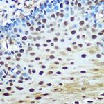 hnRNP K Antibody in Immunohistochemistry (Paraffin) (IHC (P))