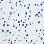 hnRNP K Antibody in Immunohistochemistry (Paraffin) (IHC (P))