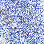 HLA-DRA Recombinant Rabbit Monoclonal Antibody (4Y9Y8)