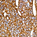 EpCAM Antibody in Immunohistochemistry (Paraffin) (IHC (P))