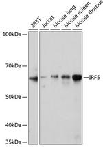 IRF5 Antibody in Western Blot (WB)