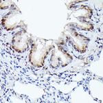 CDK4 Antibody in Immunohistochemistry (Paraffin) (IHC (P))