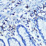 CD3z Recombinant Rabbit Monoclonal Antibody (1T5R7)