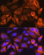 FABP1 Antibody in Immunocytochemistry (ICC/IF)
