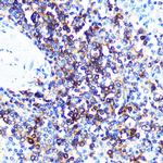 HLA-DQA1 Antibody in Immunohistochemistry (Paraffin) (IHC (P))