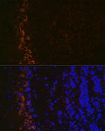 GluR2 Antibody in Immunohistochemistry (Paraffin) (IHC (P))