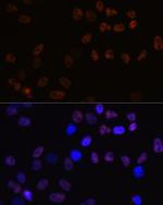 MCM7 Recombinant Rabbit Monoclonal Antibody (3U9N7)