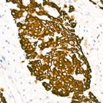Cytokeratin 5 Antibody in Immunohistochemistry (Paraffin) (IHC (P))