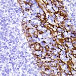Cytokeratin 5 Antibody in Immunohistochemistry (Paraffin) (IHC (P))