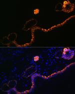 Cytokeratin 5 Antibody in Immunohistochemistry (Paraffin) (IHC (P))