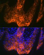 Cytokeratin 5 Antibody in Immunohistochemistry (Paraffin) (IHC (P))
