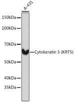 Cytokeratin 5 Antibody in Western Blot (WB)