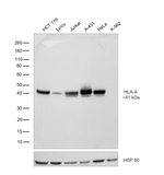 HLA-A Antibody in Western Blot (WB)
