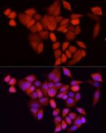 CDK1 Antibody in Immunocytochemistry (ICC/IF)