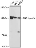 DNA Ligase IV Recombinant Rabbit Monoclonal Antibody (2T6J2)