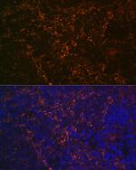 CD23 Antibody in Immunohistochemistry (Paraffin) (IHC (P))
