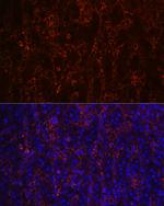 CD23 Recombinant Rabbit Monoclonal Antibody (9K9U5)