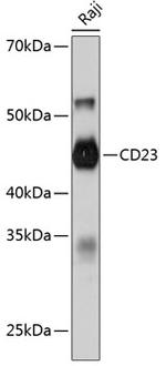 CD23 Antibody in Western Blot (WB)