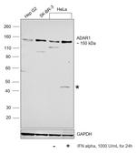 ADAR1 Antibody in Western Blot (WB)