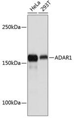 ADAR1 Antibody in Western Blot (WB)