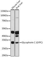 GYPC Antibody in Western Blot (WB)