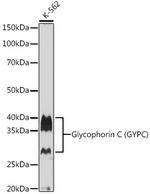 GYPC Antibody in Western Blot (WB)