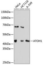ATOH1 Recombinant Rabbit Monoclonal Antibody (7N3G2)
