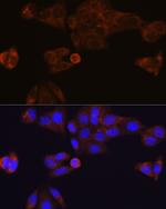 CES1 Recombinant Rabbit Monoclonal Antibody (7C9R6)