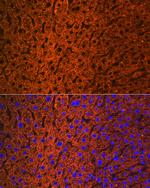 CES1 Antibody in Immunohistochemistry (Paraffin) (IHC (P))