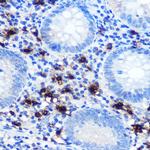 Mast Cell Chymase Recombinant Rabbit Monoclonal Antibody (2O4P8)